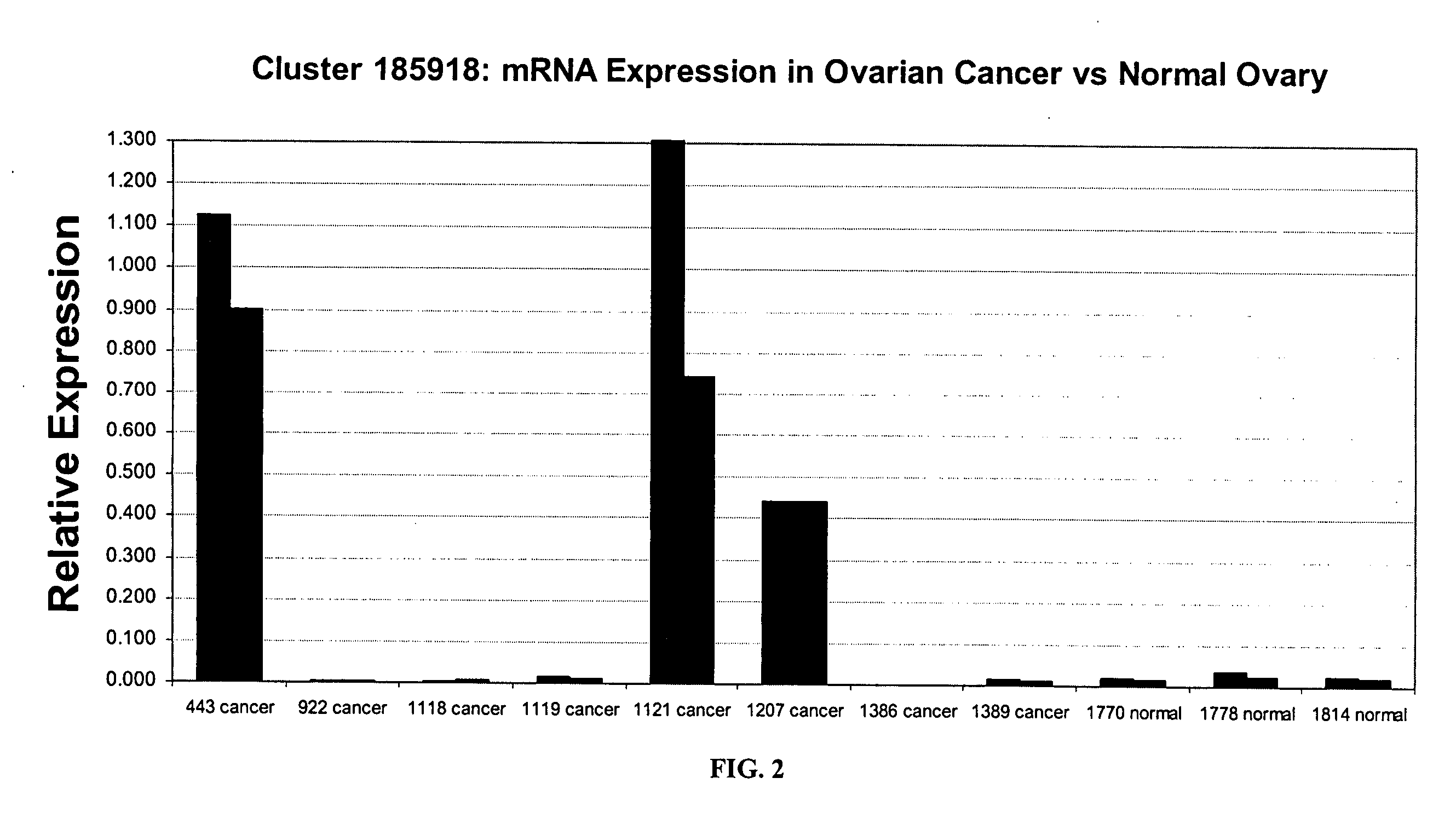 LRRTM1 Compositions and Methods of Their Use for the Diagnosis and Treatment of Cancer