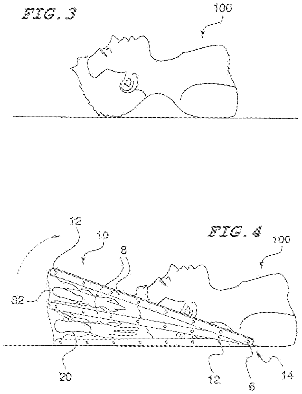 Patient airway dome and methods of making and using same
