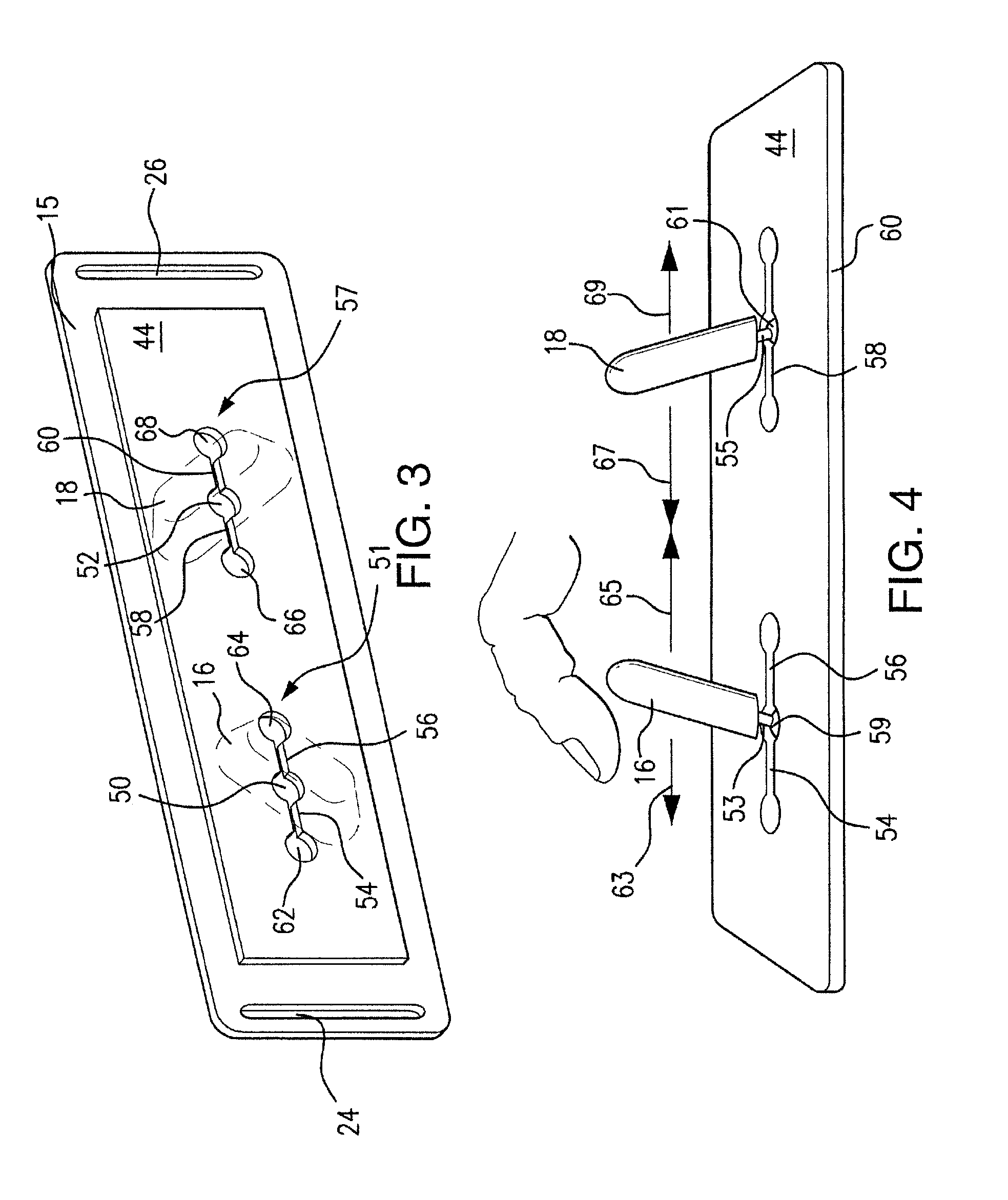 Anti-reflux/heartburn treatment device