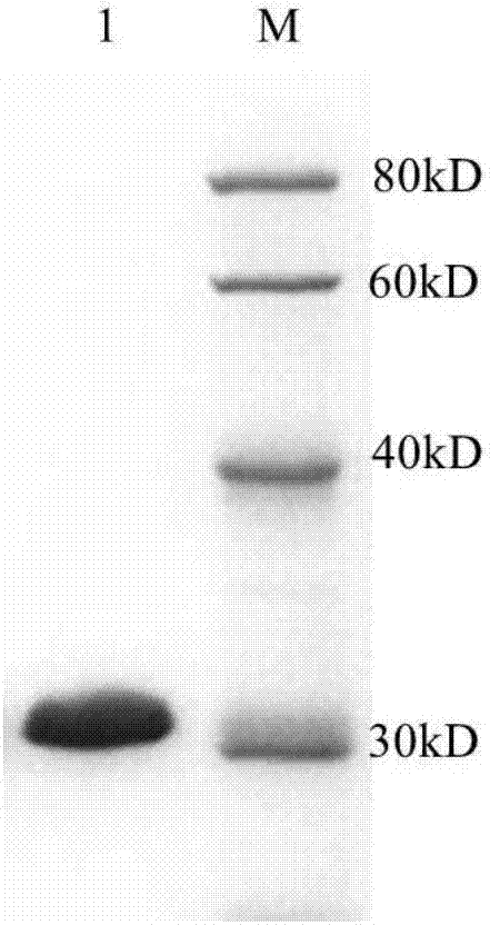 A colloidal gold test strip for detecting toxoplasma gondii antibody