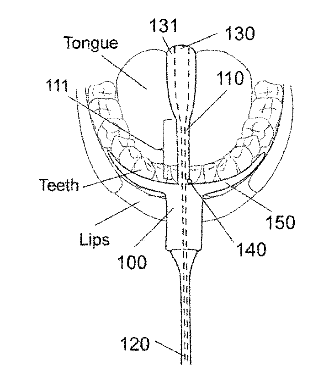 Oral device to eliminate air space in oral cavity