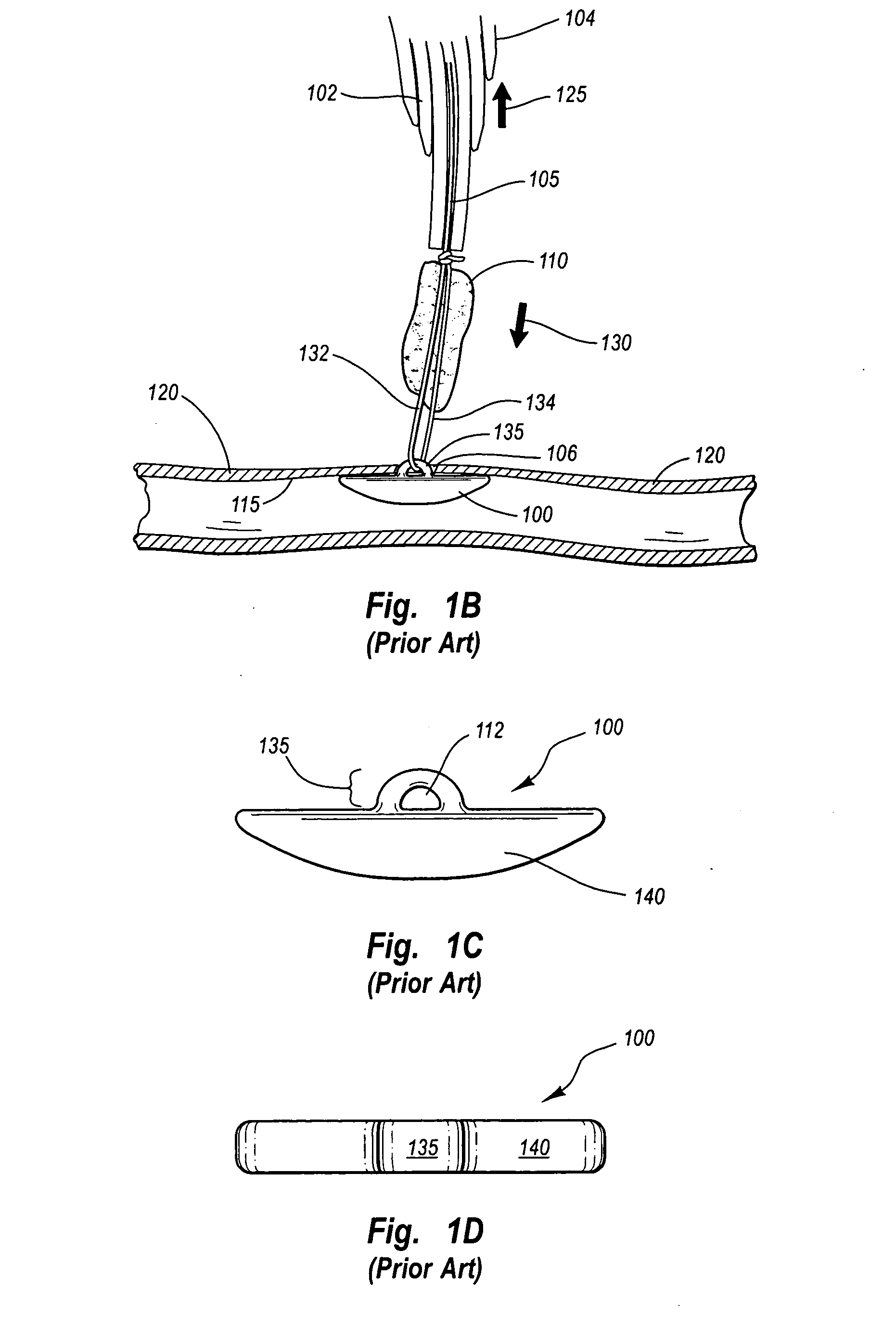 Arteriotomy closure device with anti-roll anchor
