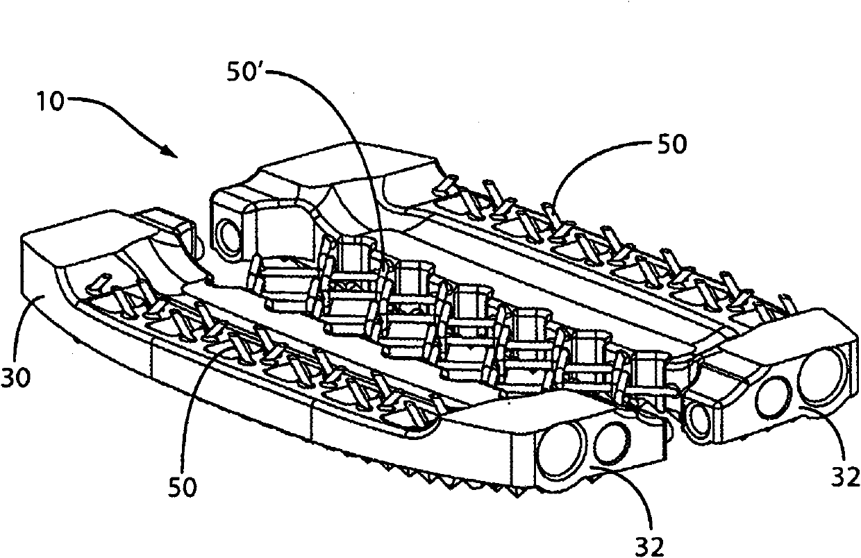 An expandable intervertebral implant and associated method of manufacturing the same