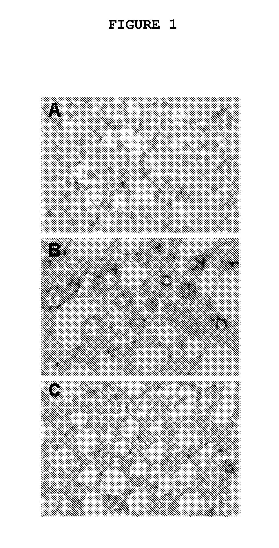Composition and Method for Treating Fibrotic Diseases