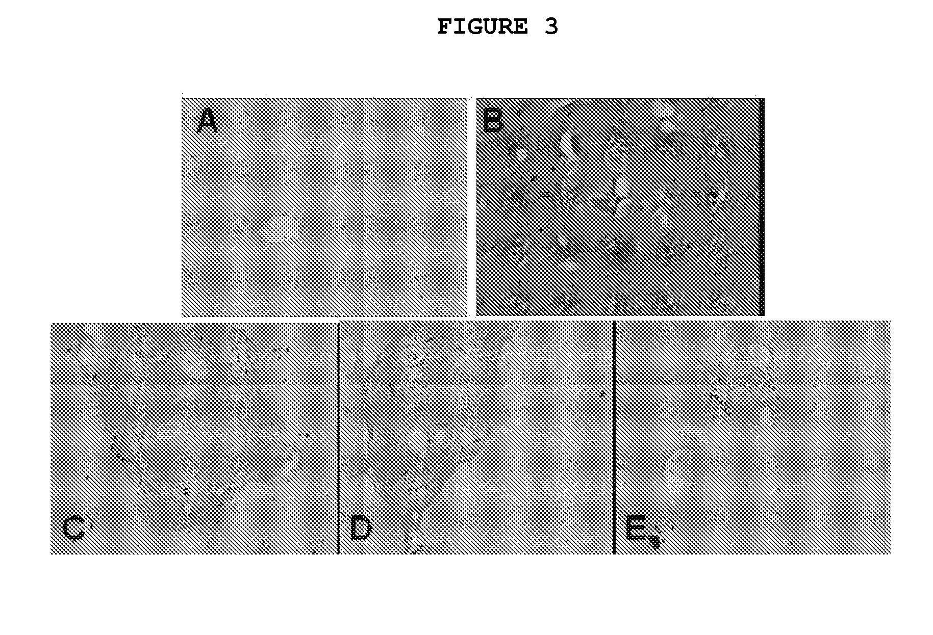 Composition and Method for Treating Fibrotic Diseases