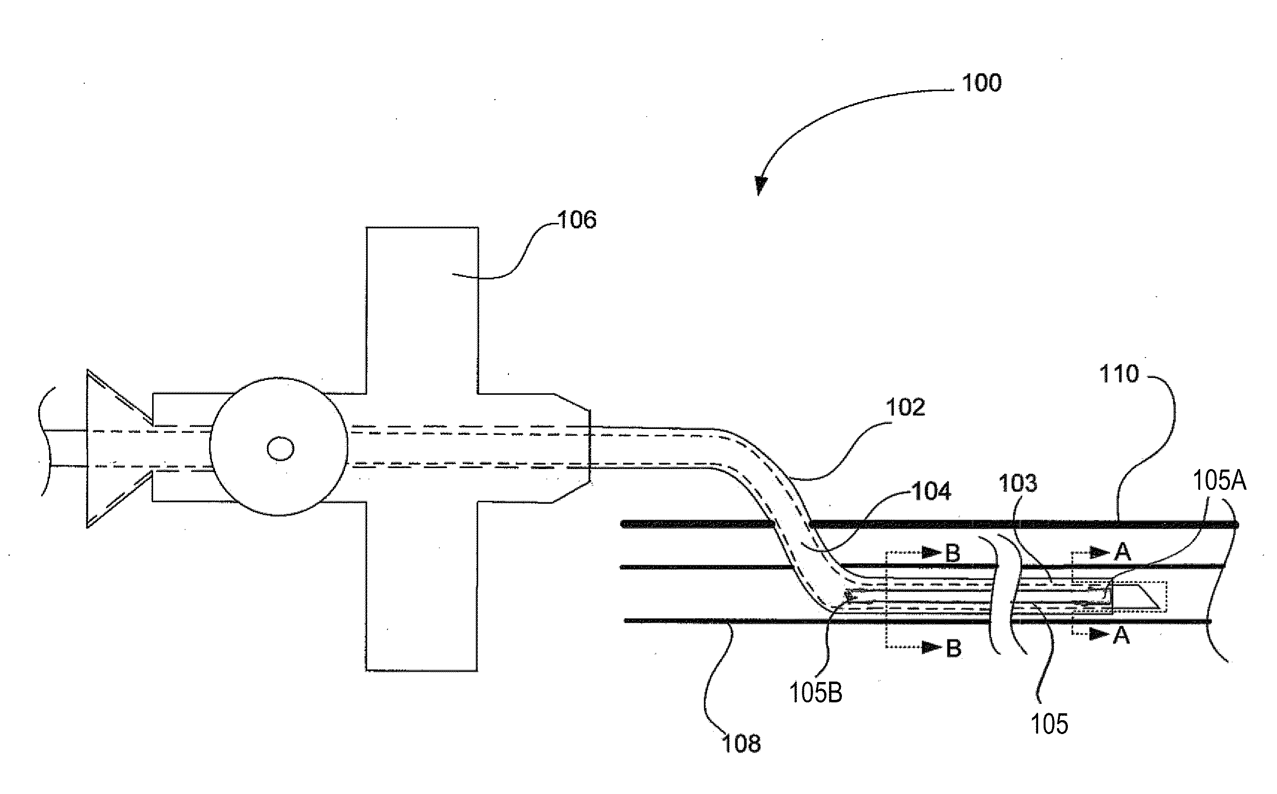 Intravenous cannula