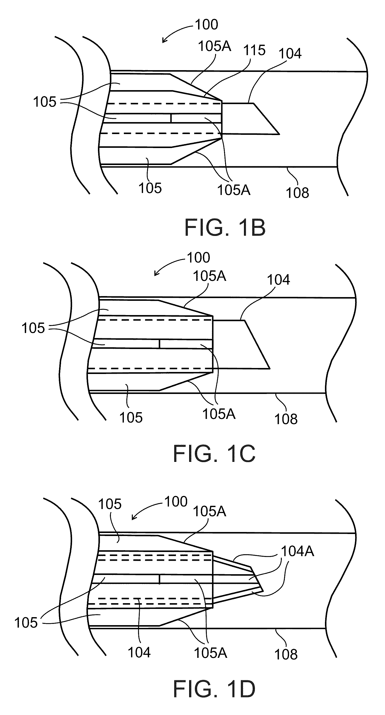 Intravenous cannula