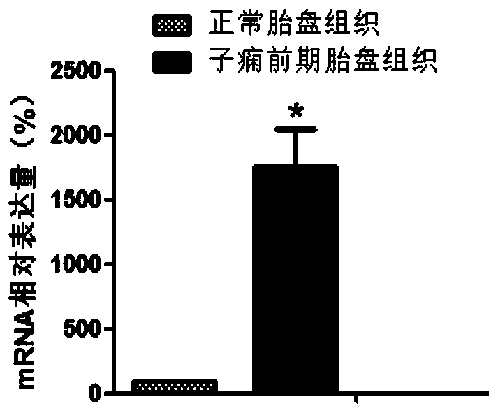 vwce gene and its application in the diagnosis and treatment of preeclampsia