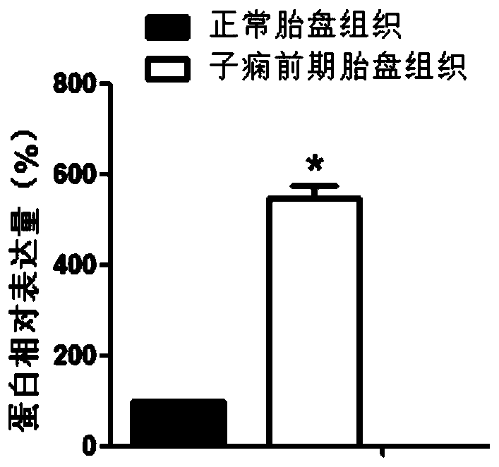 vwce gene and its application in the diagnosis and treatment of preeclampsia