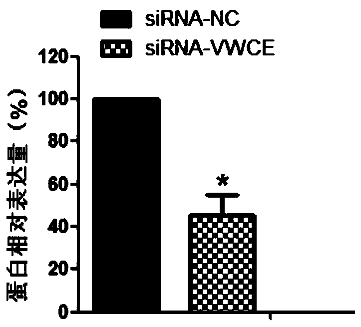 vwce gene and its application in the diagnosis and treatment of preeclampsia