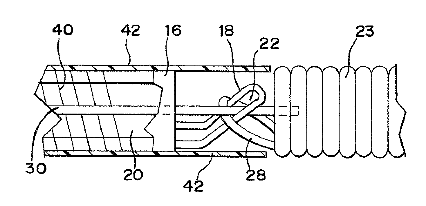 Stretch resistant embolic coil delivery system with combined mechanical and pressure release mechanism