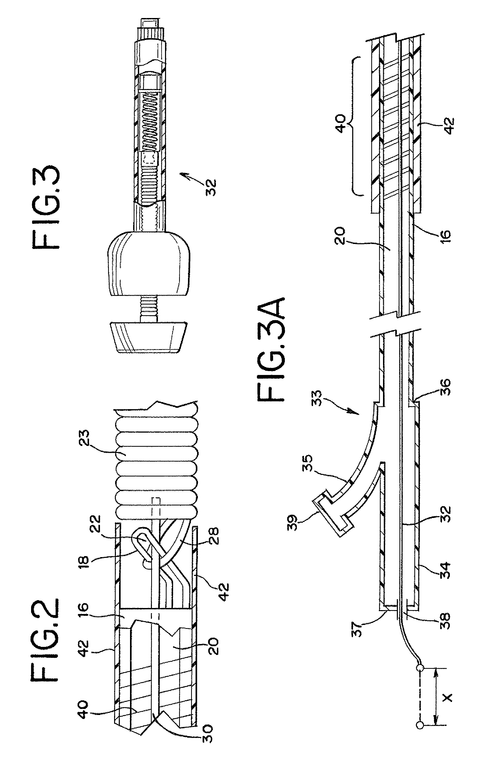 Stretch resistant embolic coil delivery system with combined mechanical and pressure release mechanism