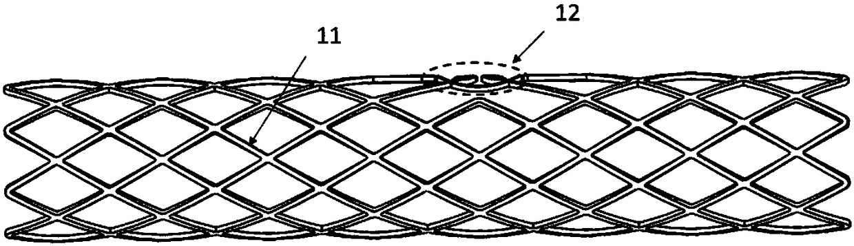 Degradable stent system for bifurcation vascular lesions