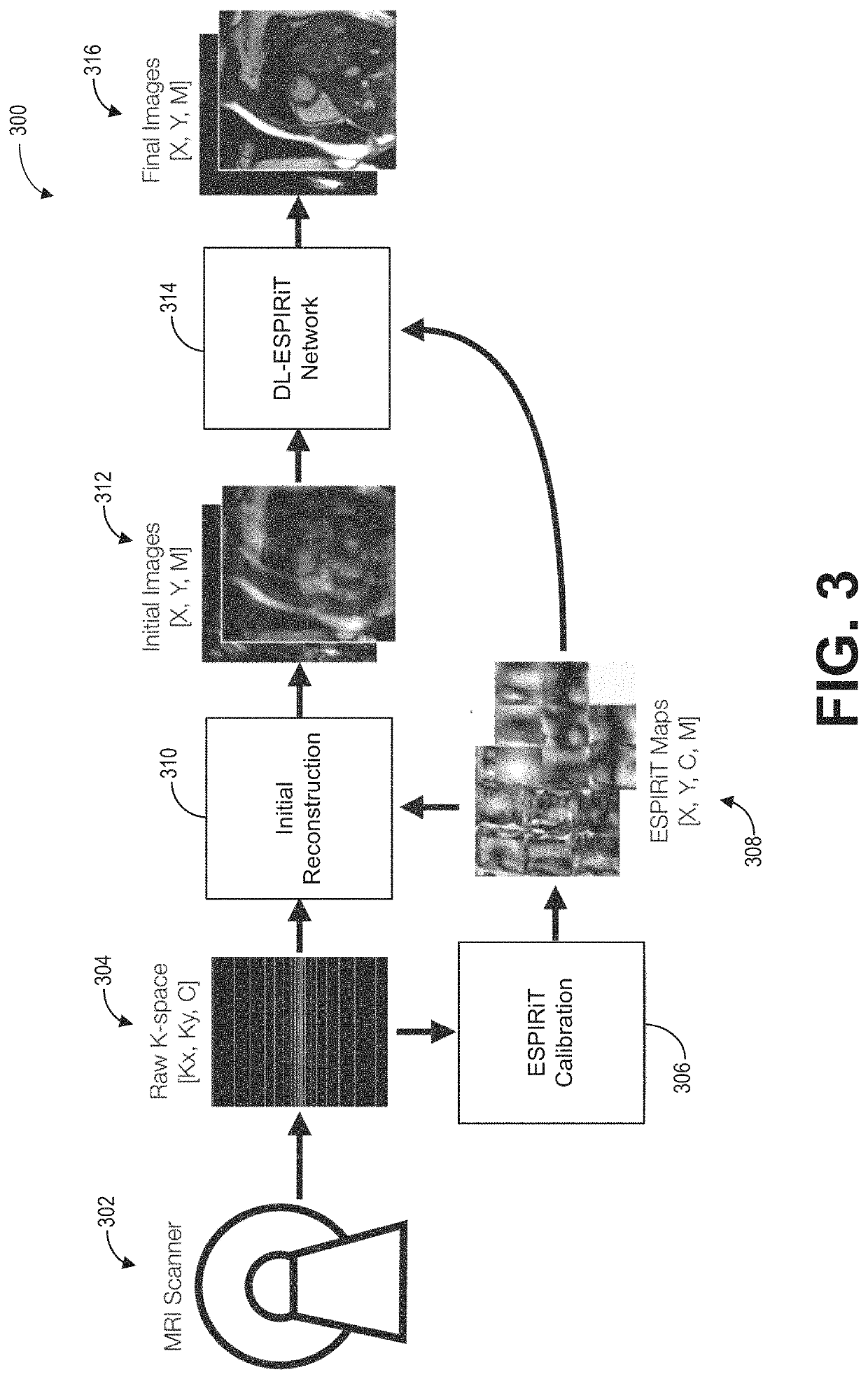 Methods and systems for magnetic resonance image reconstruction using an extended sensitivity model and a deep neural network