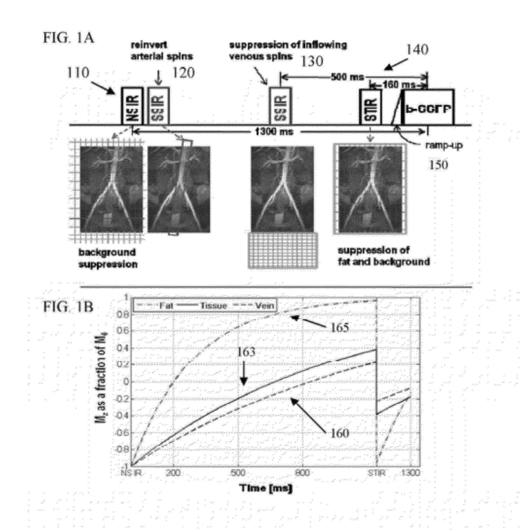 Apparatus and Method of Non-Contrast Magnetic Resonance Angiography of Abdominal and Pelvic Arteries
