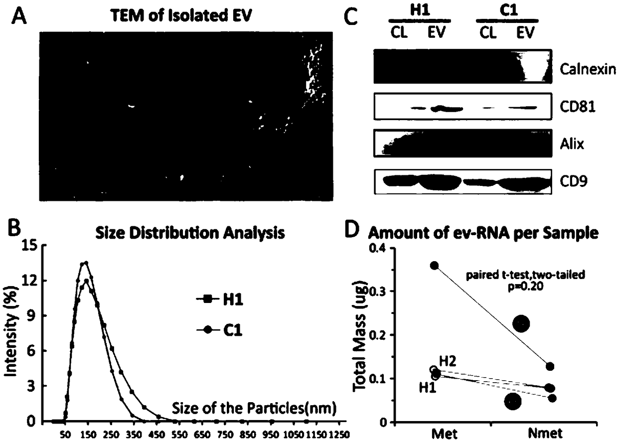 Blood circulation exosome RNA based detection for gene mutation related to osteosarcoma pulmonary metastasis and application thereof