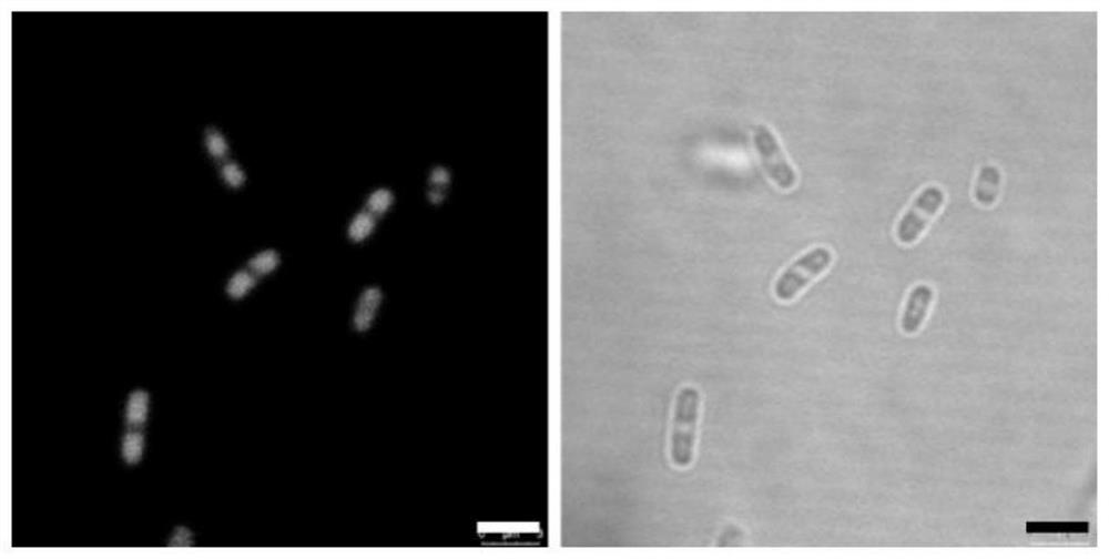 Construction and application of membraneless organelles in prokaryotes