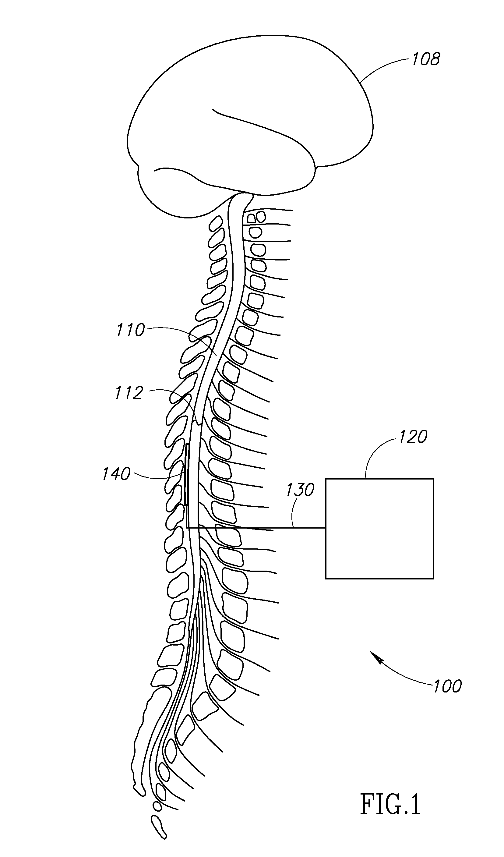 Spinal stimulator systems for restoration of function