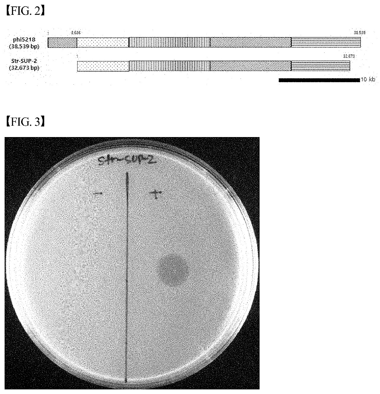 Novel streptococcus suis bacteriophage str-sup-2, and use thereof for inhibiting proliferation of streptococcus suis strains
