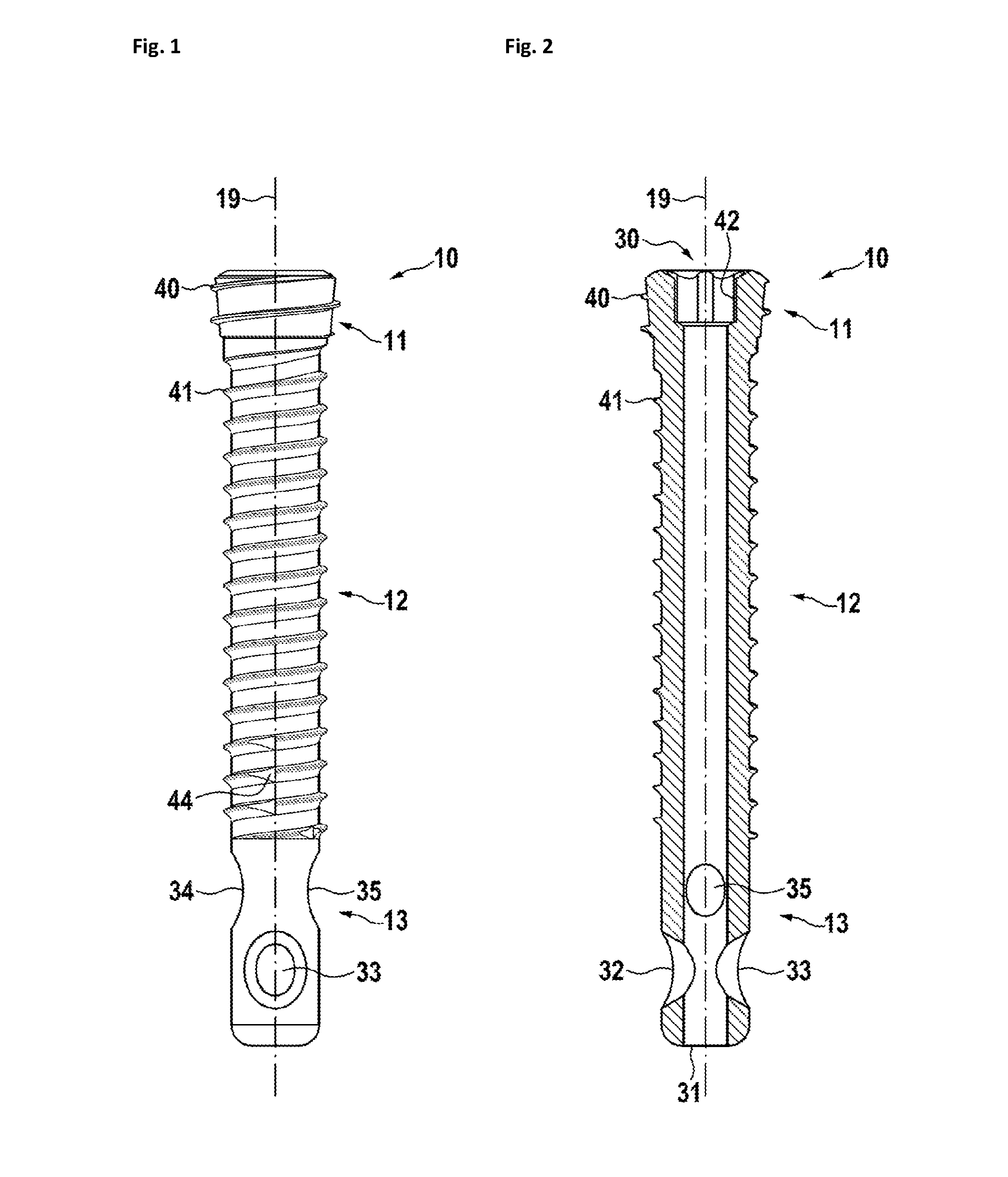 Cannulated bone screws