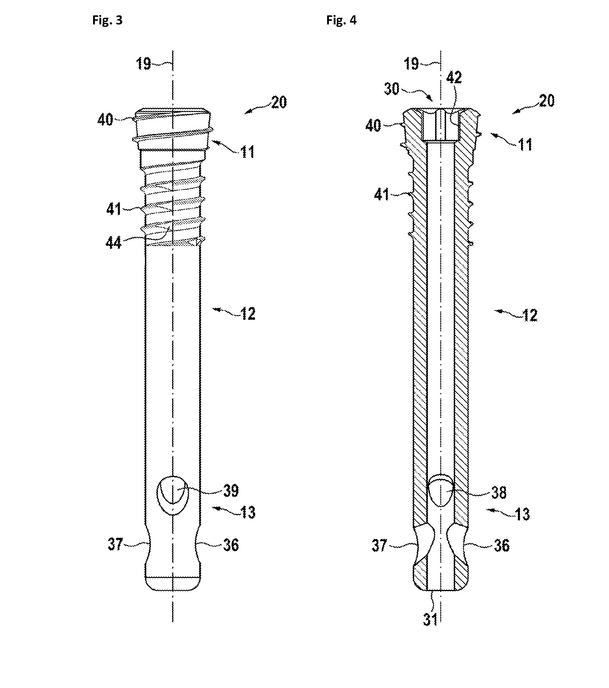 Cannulated bone screws