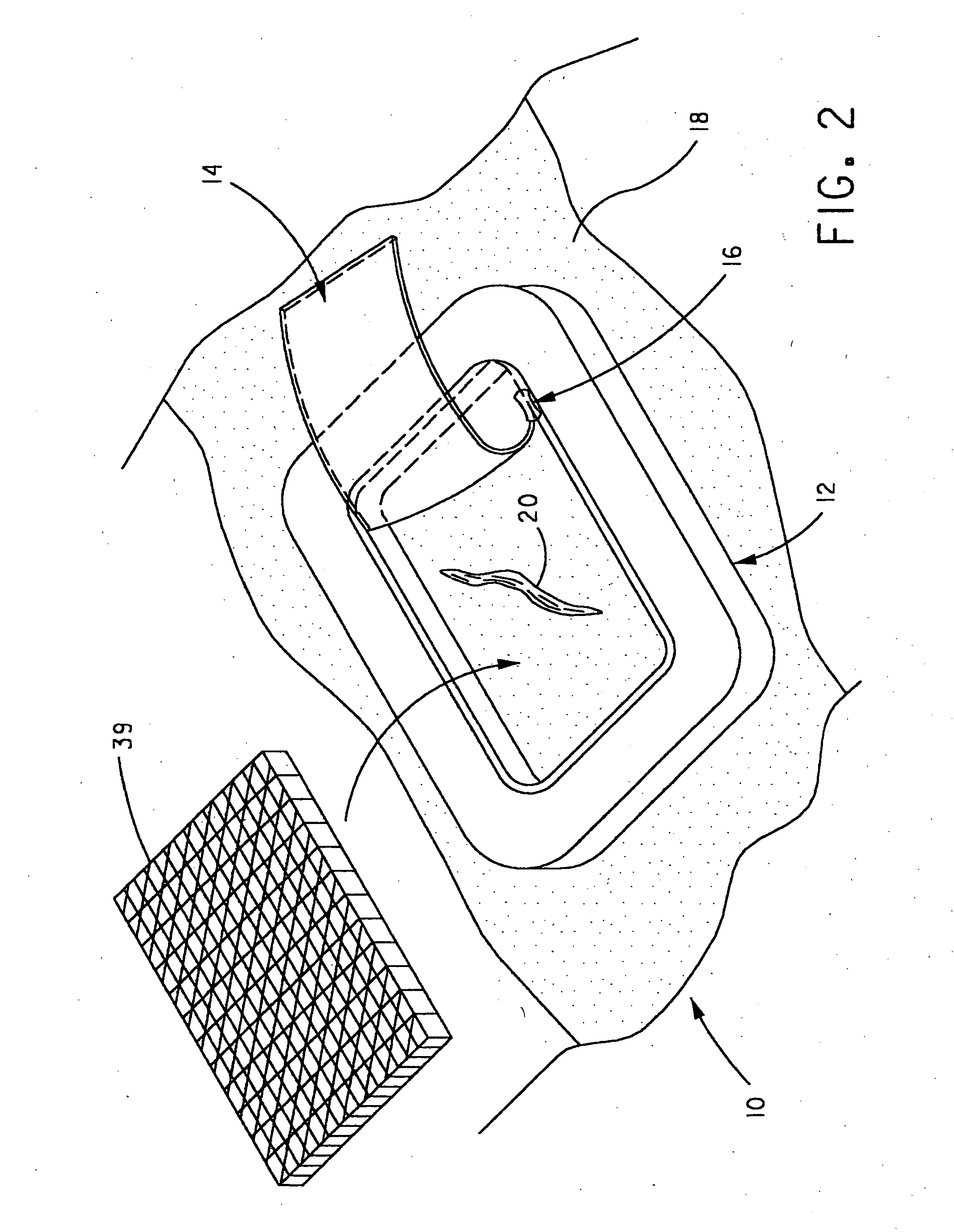 Wound dressing retainer and fastening device