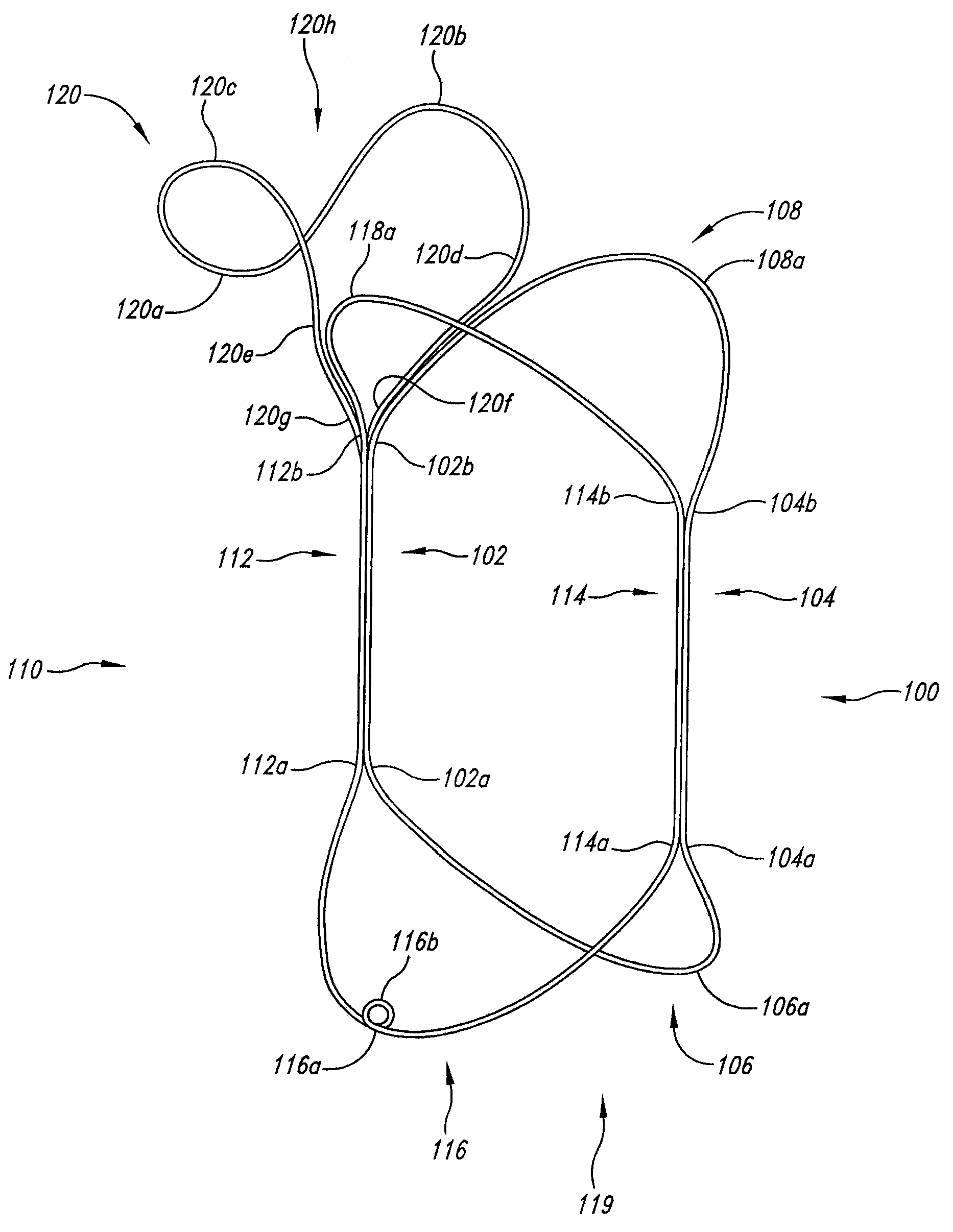 Vascular anchoring system and method