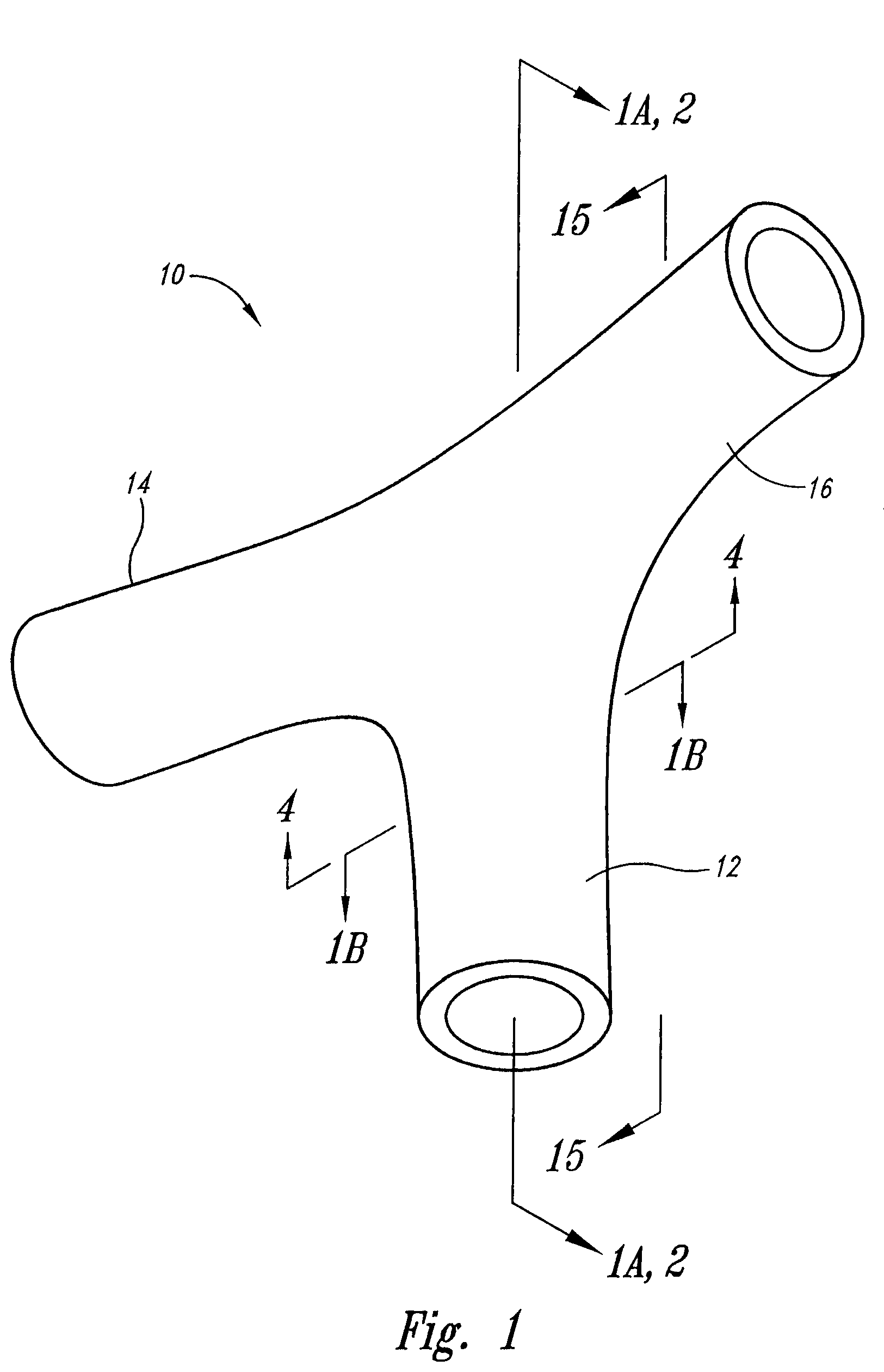 Vascular anchoring system and method