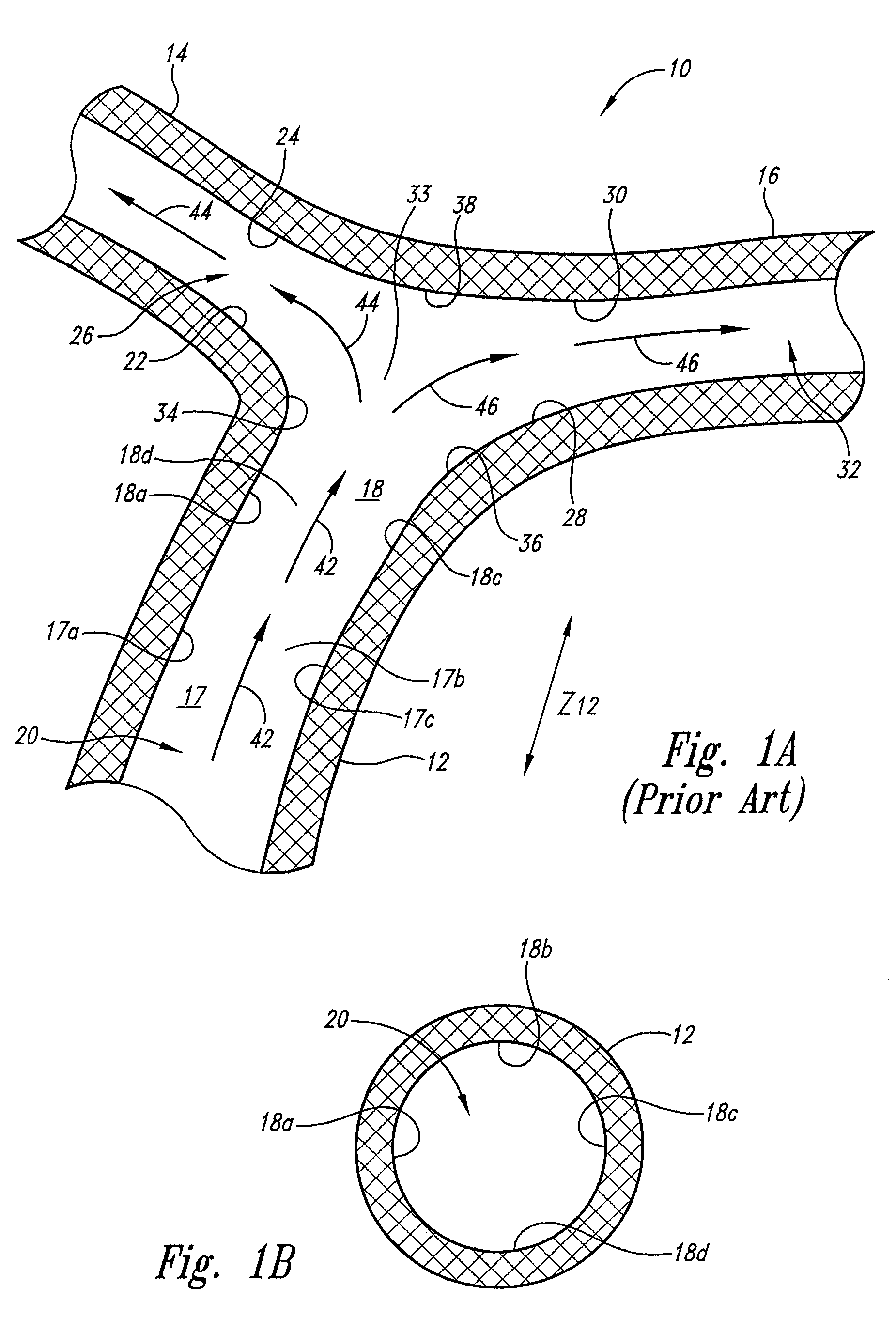 Vascular anchoring system and method