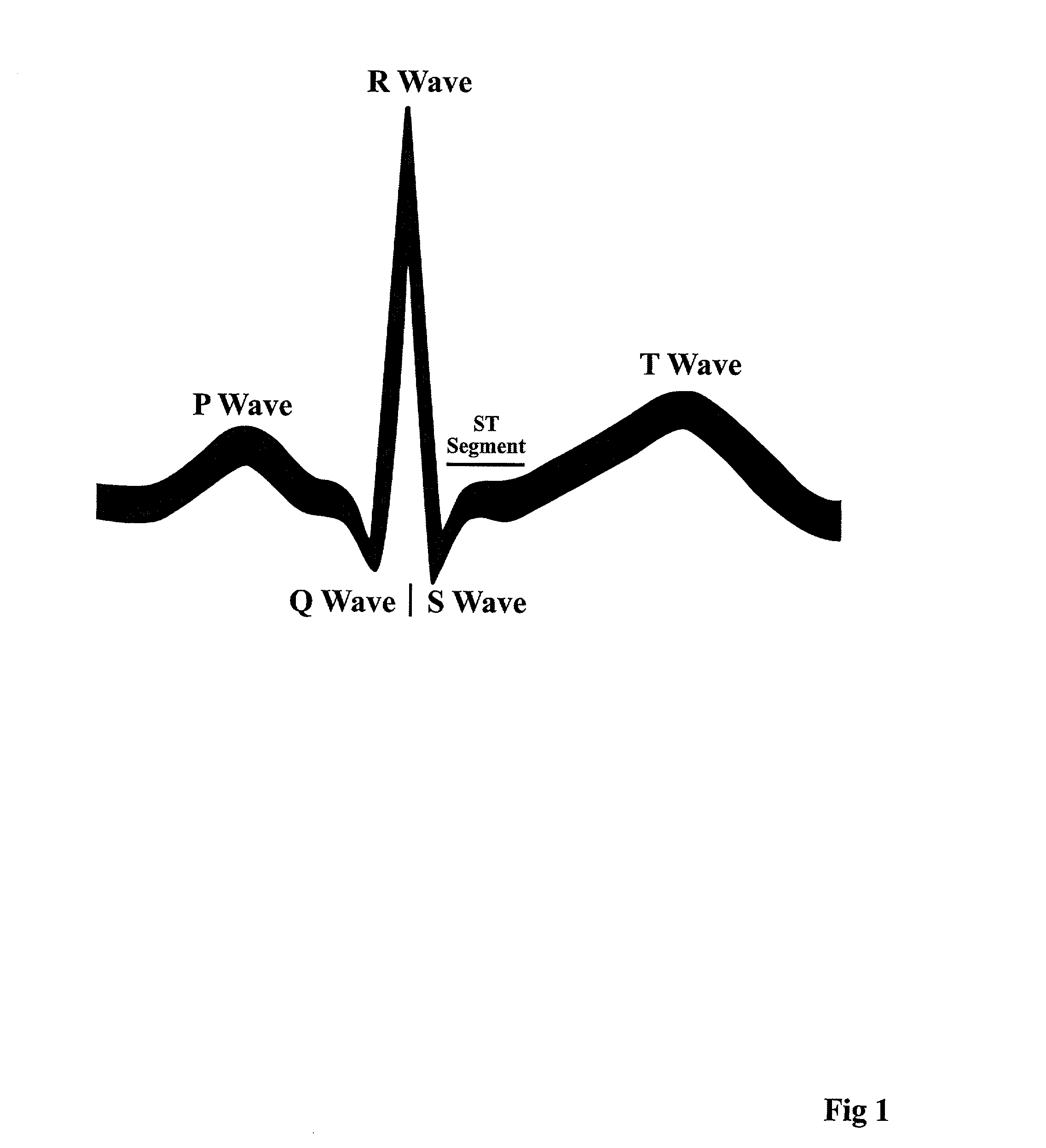 High-resolution medical monitoring apparatus particularly useful for electrocardiographs