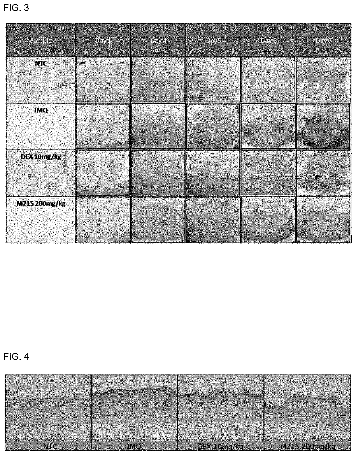 Composition for ameliorating psoriasis symptoms containing extract of sphallerocarpus gracilis