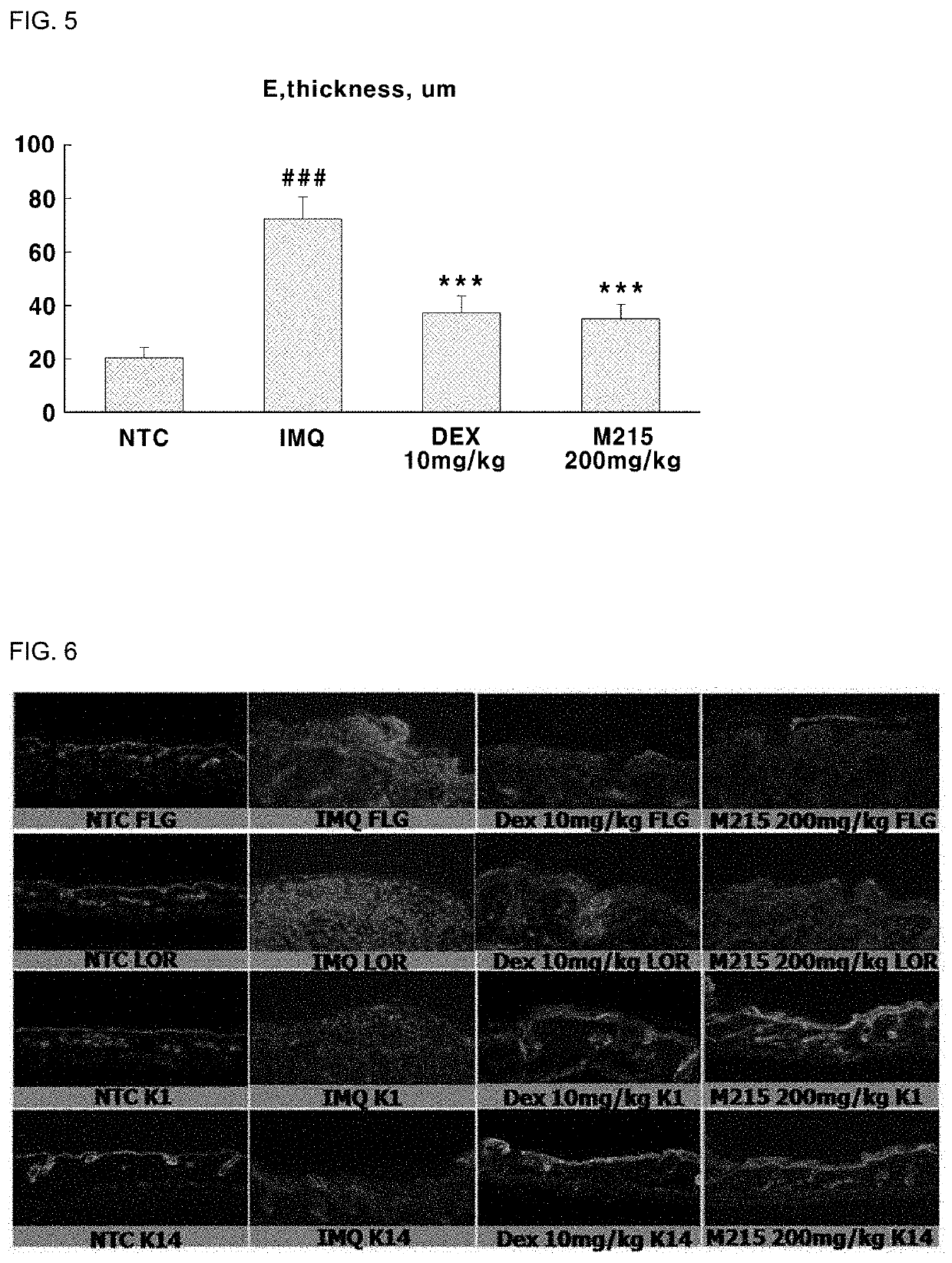 Composition for ameliorating psoriasis symptoms containing extract of sphallerocarpus gracilis