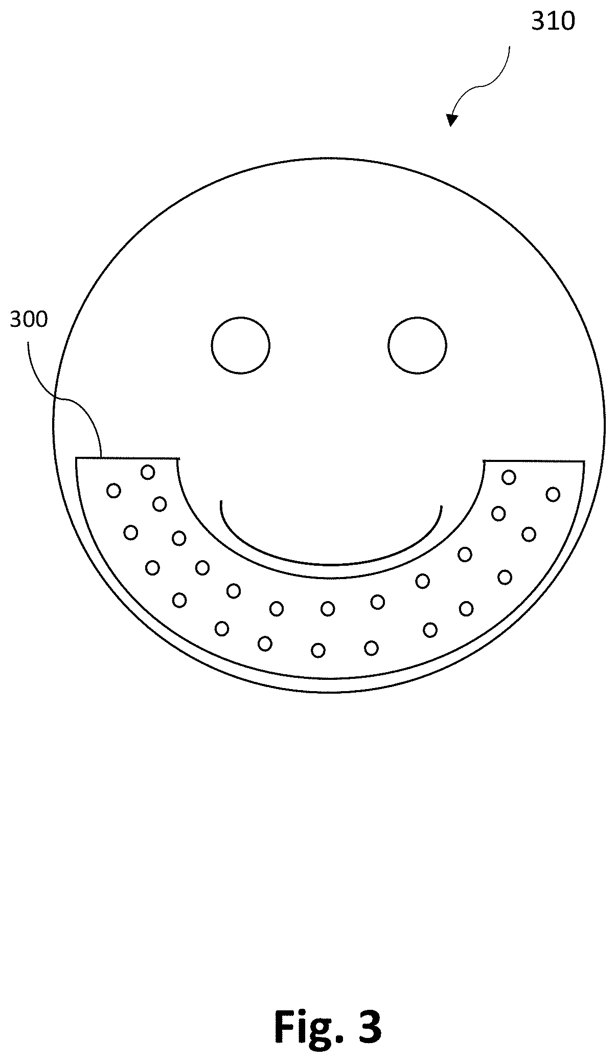 Electrical stimulation system for facial expressions and a method of use thereof