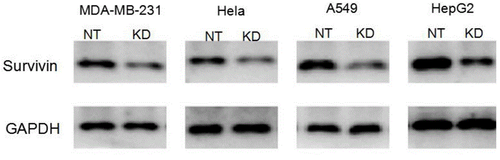 siRNA molecule for inhibiting survivin gene expression and application of siRNA molecule