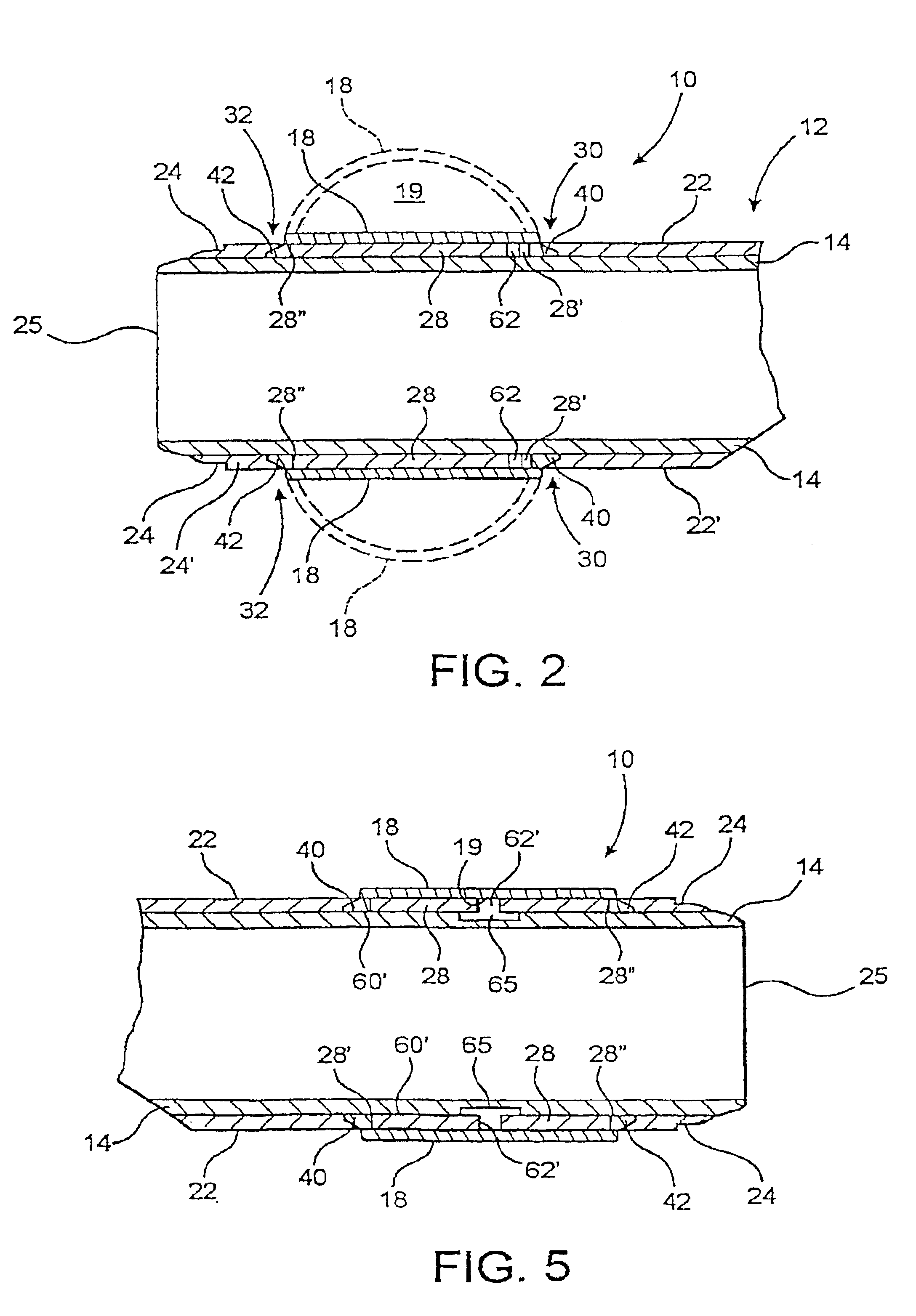 Anchoring assembly for a medical instrument