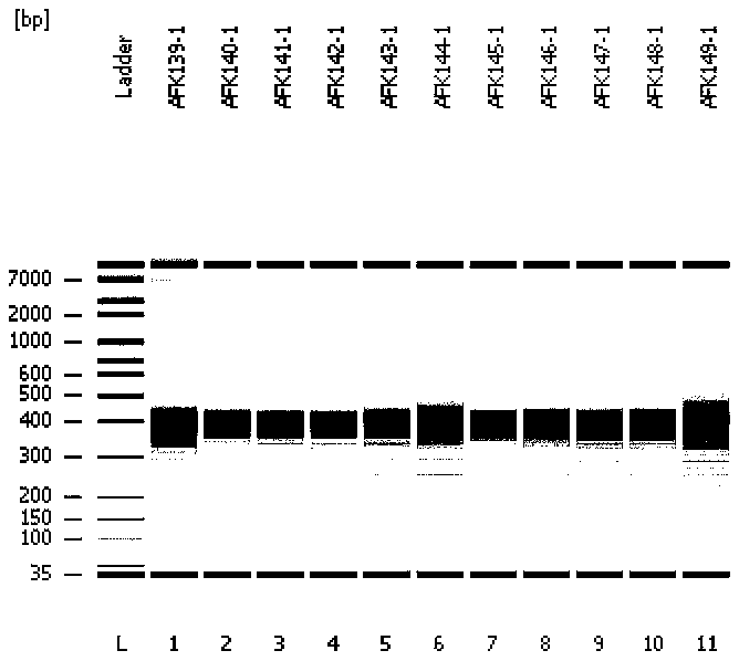 Congenital absence susceptibility gene detection method