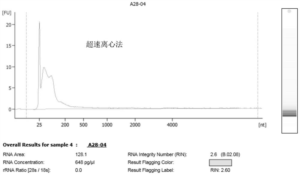 Biomarkers and detection kits for prostate cancer diagnostic grading and benign and malignant prediction