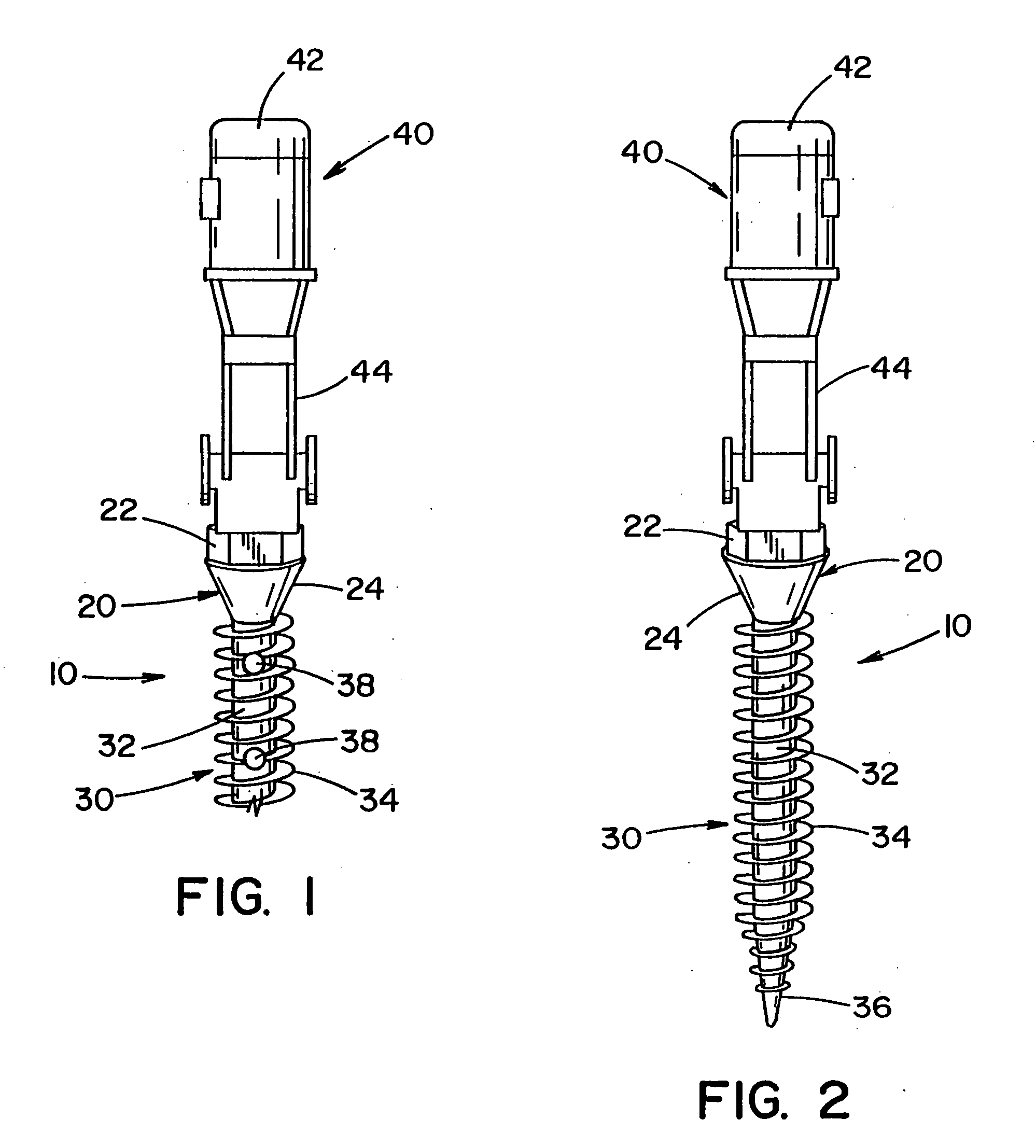 Implant device