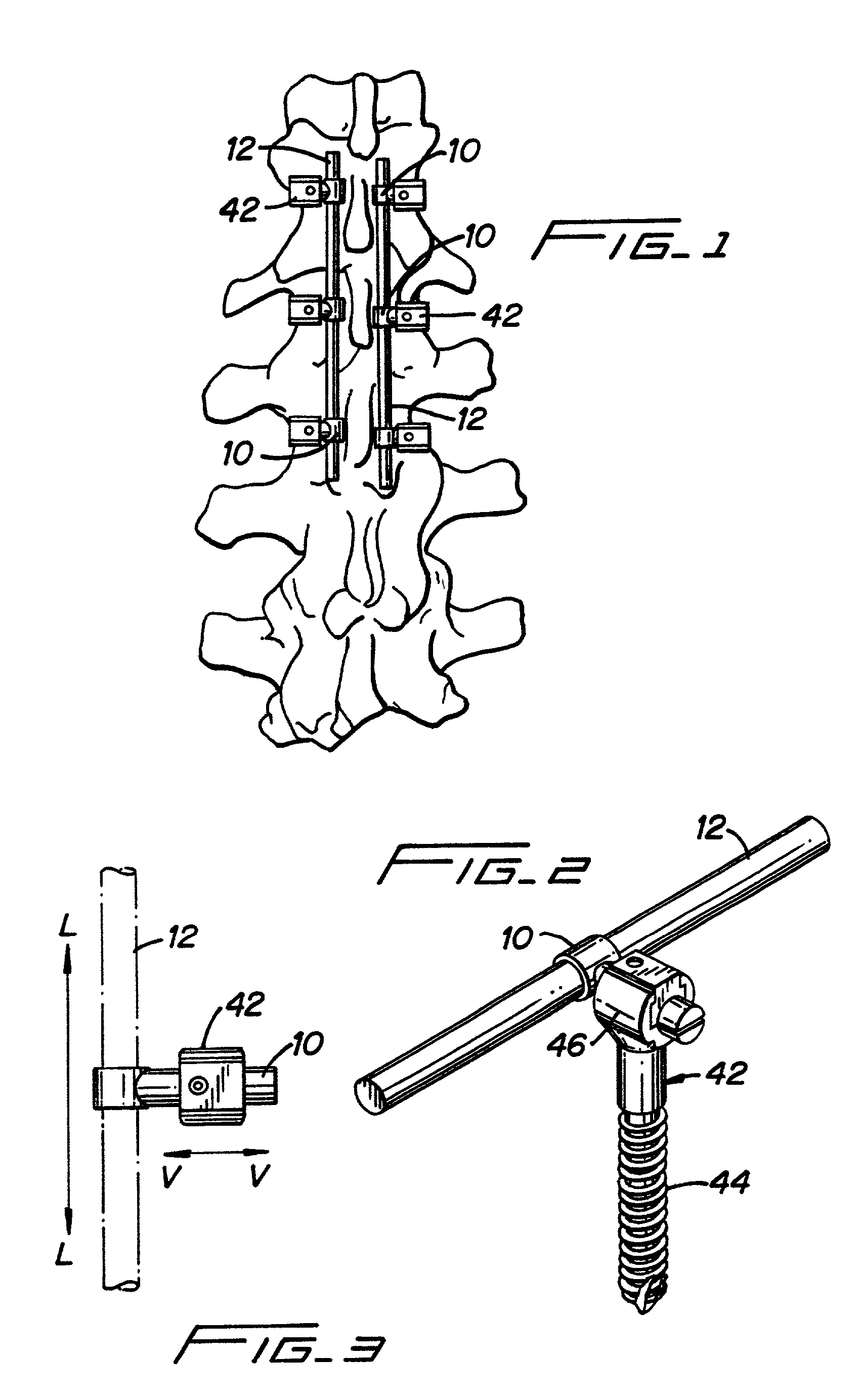 Clamping connector for spinal fixation systems