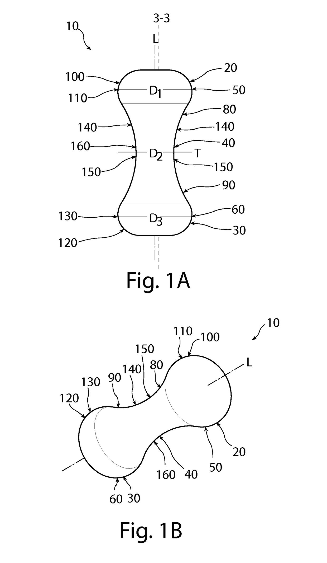 Method of conforming an overwrap to a pessary device