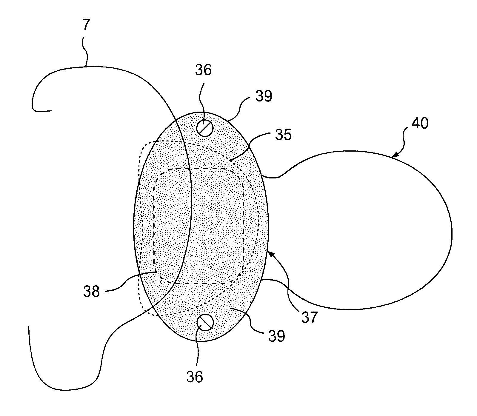 Cochlear implant component having a unitary faceplate