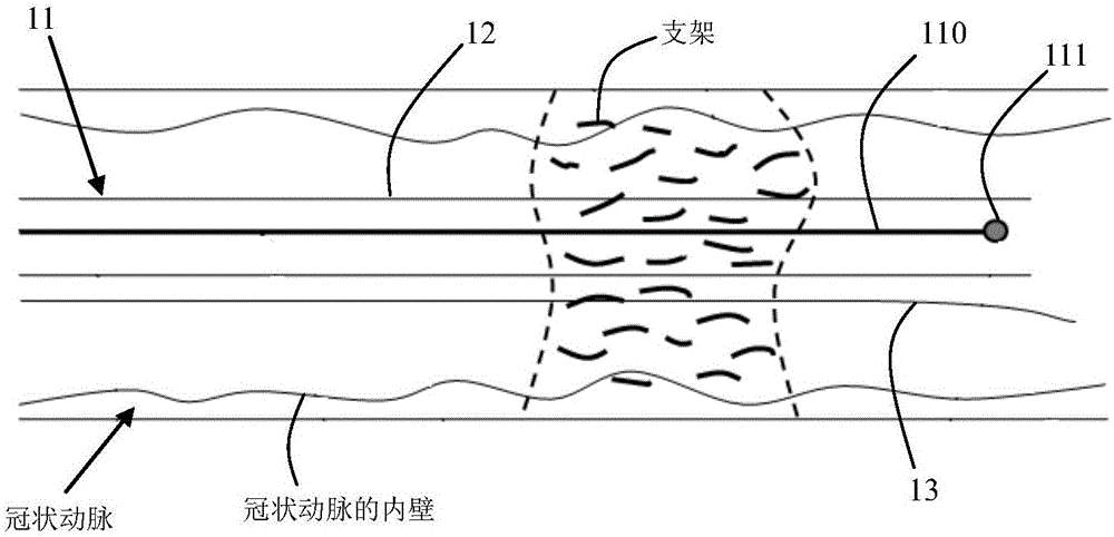 Method and system for automatically detecting and evaluating cardiovascular implanted stents on basis of OCT (optical coherence tomography)