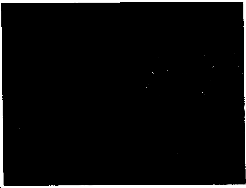 Human papilloma virus sample particle vaccines