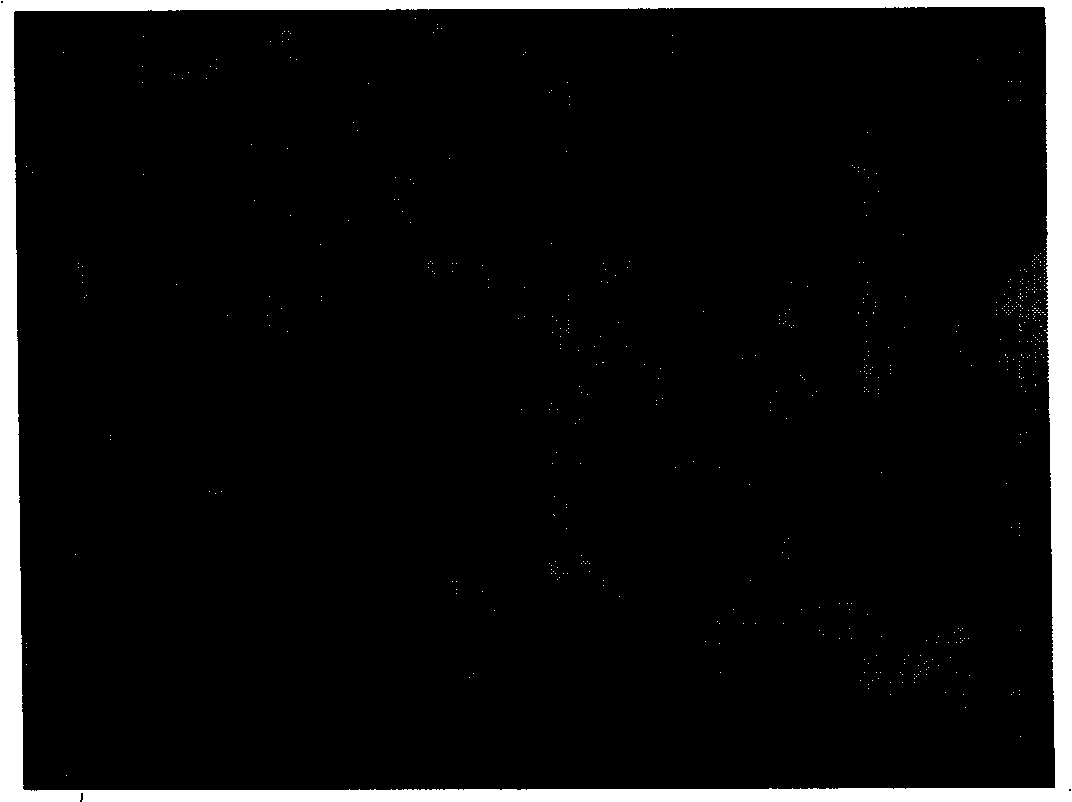 Human papilloma virus sample particle vaccines