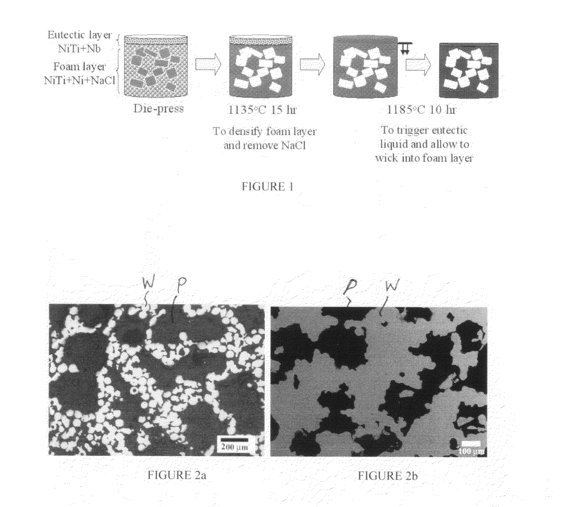 Method of making metallic foams and foams produced