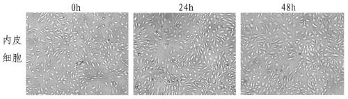 Tumorized human umbilical vein endothelial cell vaccine and its application in anticancer