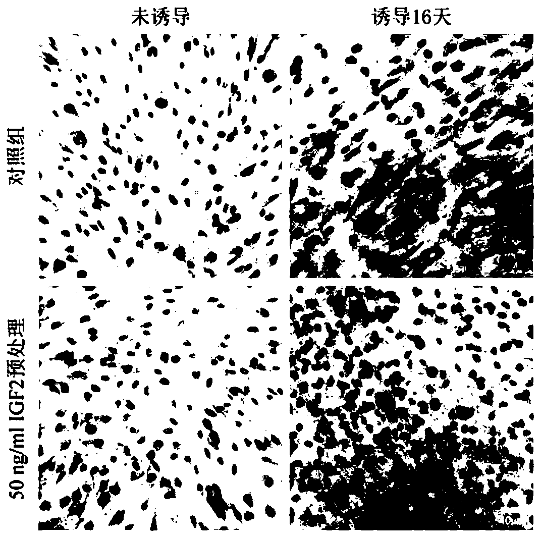 Application of insulin-like growth factor 2 in promoting differentiation of human skin fibroblasts into adipocytes