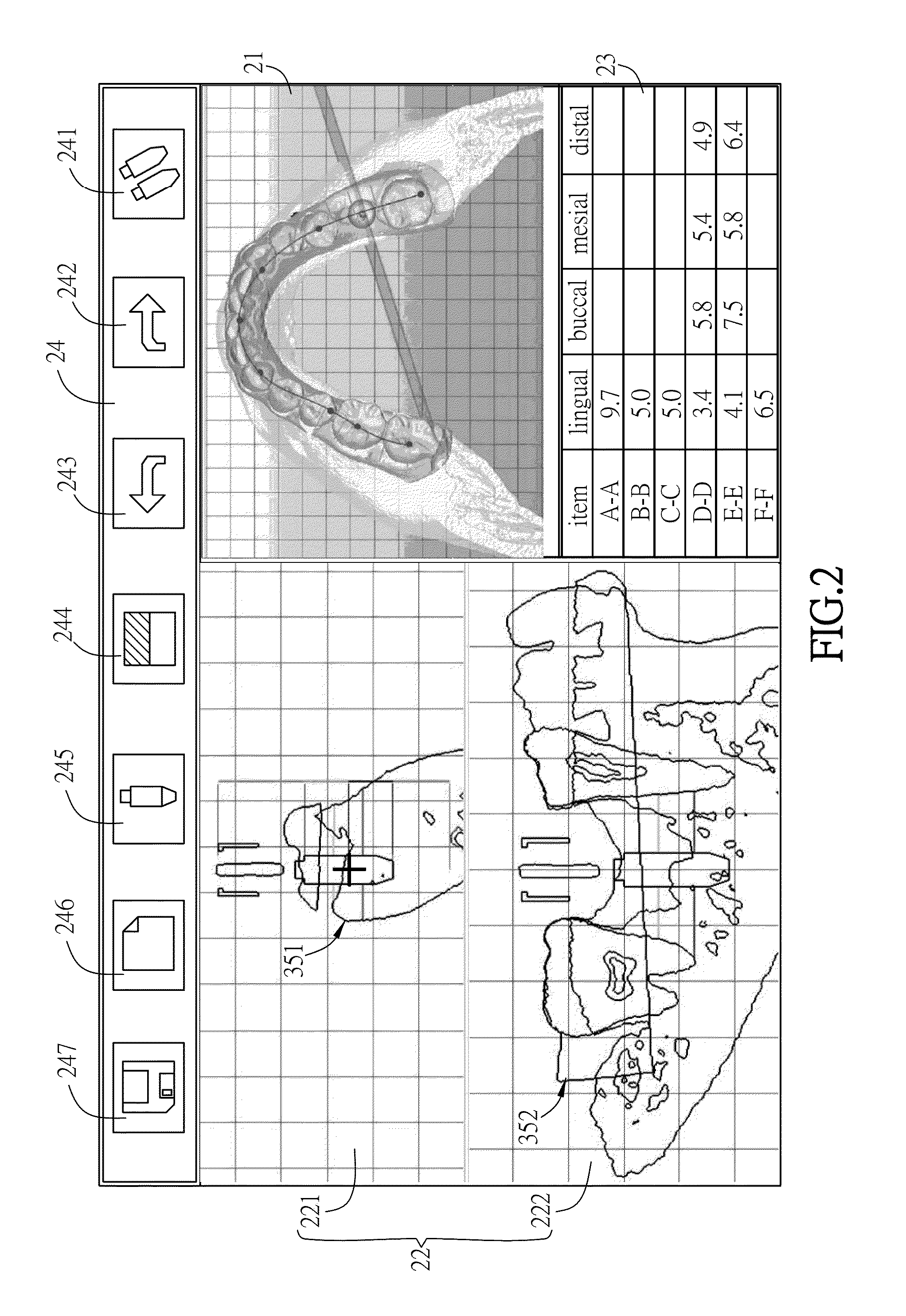 Method and system for dental implant path planning