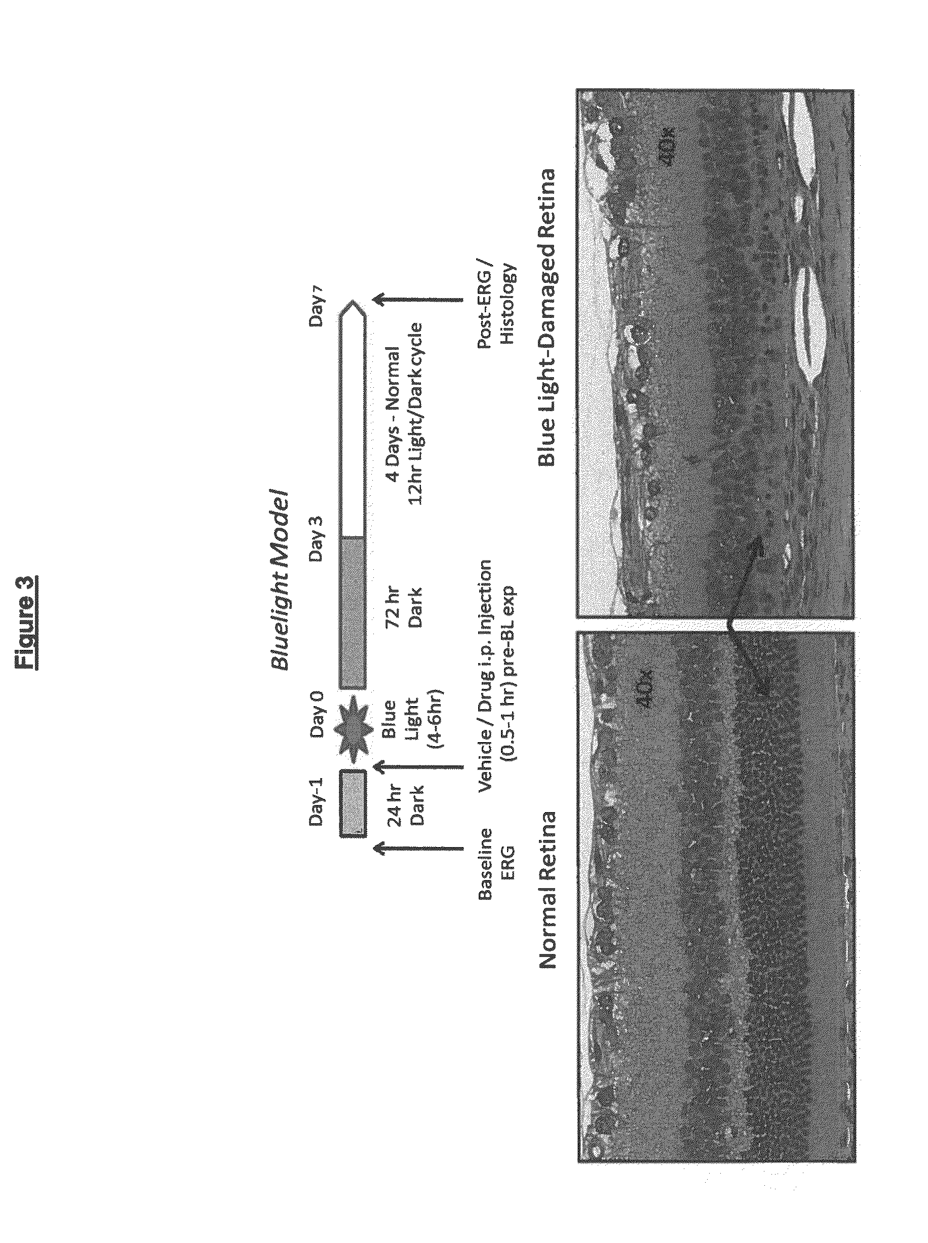 Benzimidazole derivatives as selective blockers of persistent sodium current