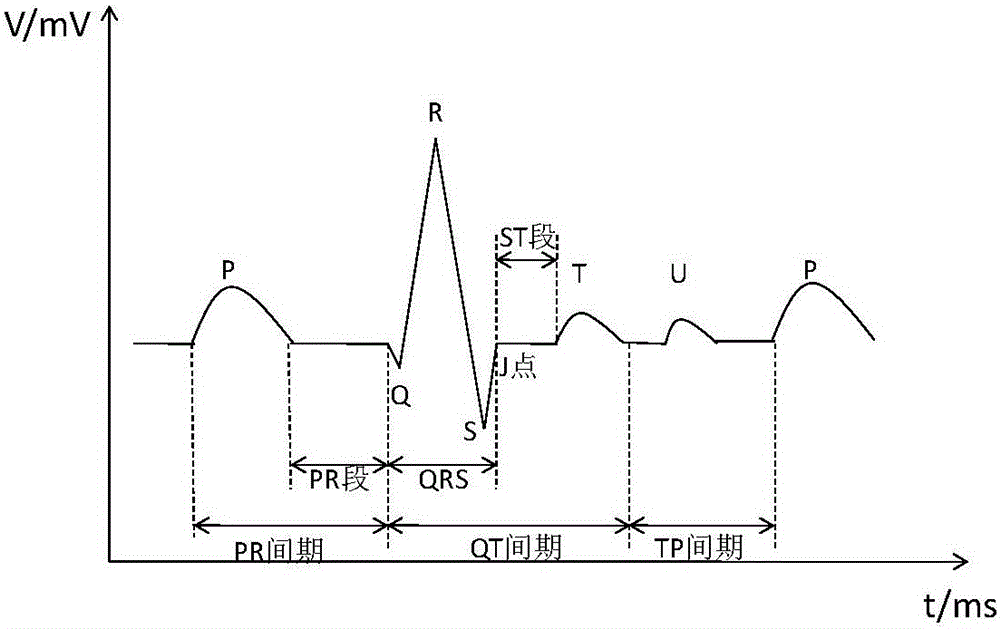 Electrocardiogram signal R wave positioning method